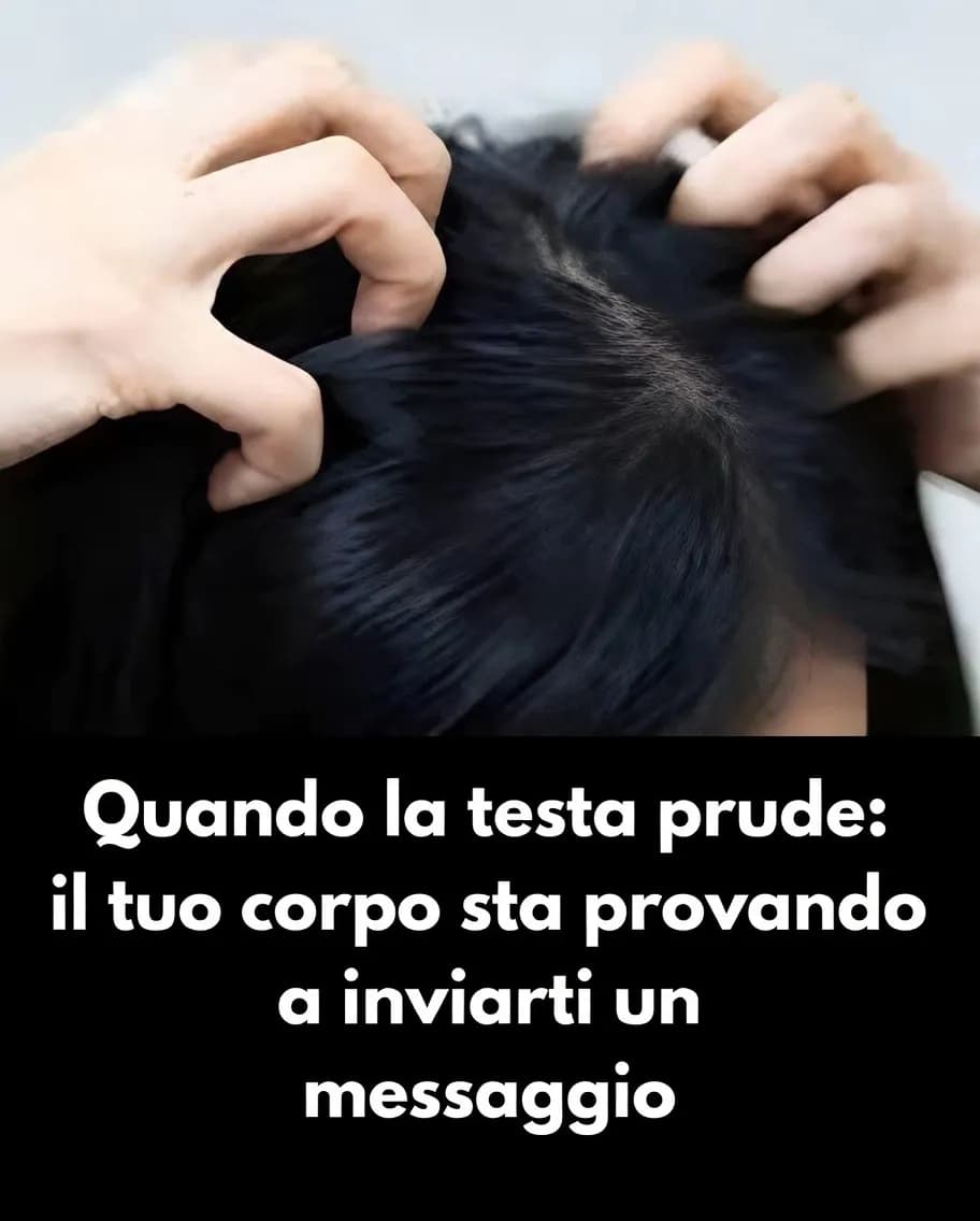 Irritazione del cuoio capelluto: identifica le cause del fastidio e come trattarle