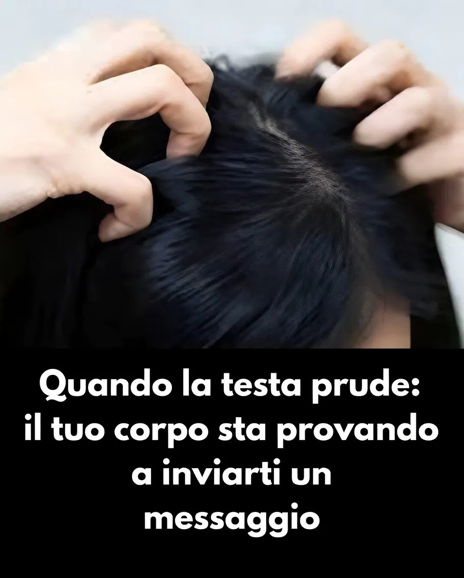 Irritazione del cuoio capelluto: identifica le cause del fastidio e come trattarle