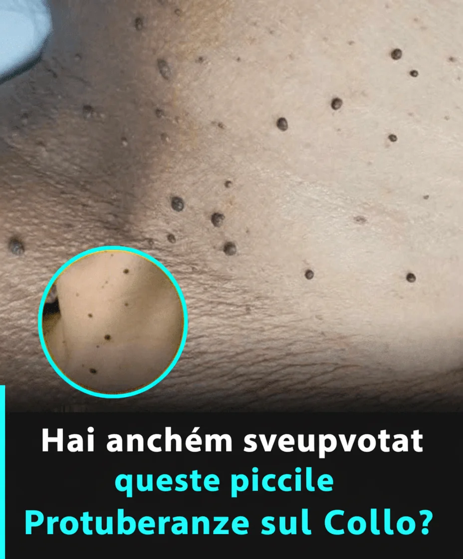 Se hai notato questi piccoli frammenti di pelle sul collo o sotto le ascelle, ecco cosa potrebbero essere…