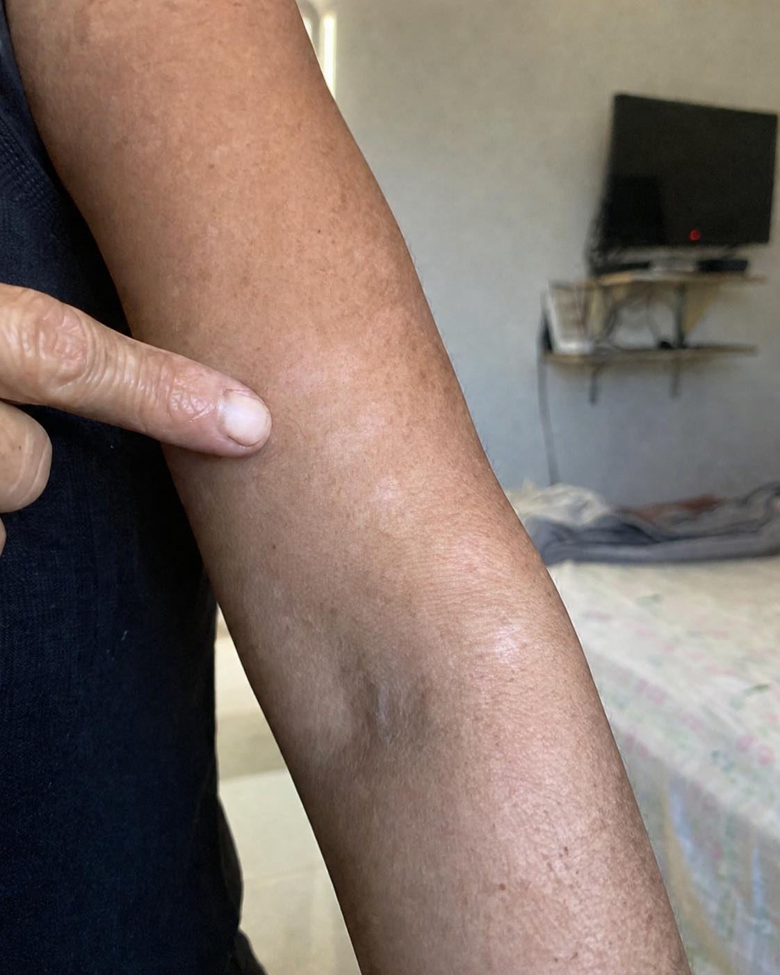 Macchie bianche sulla pelle: cosa indicano? Scopri le possibili cause