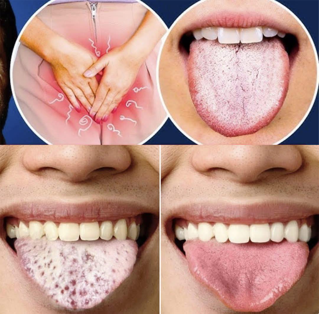 Lingua bianca, affaticamento e insonnia: sai cosa possono indicare questi sintomi?