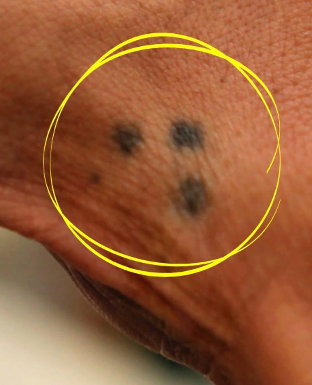 Se vedi qualcuno con un tatuaggio a tre punti sulla mano, è meglio fare attenzione…